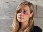 sad abuse young woman