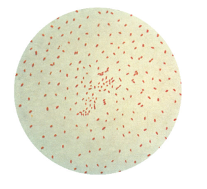 This Gram-stained photomicrograph depicts pertussis bacteria also known as whooping cough-CDC image.