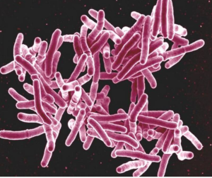 KHI photo via Mycobacterium tuberculosis bacteria, the cause of TB, as seen in a scanning electron micrograph. NATIONAL INSTITUTE OF ALLERGY AND INFECTIOUS DISEASES