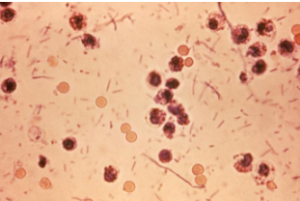 Shigella bacteria is responsible for a recent infectious disease outbreak in Kansas City children. CREDIT CENTERS FOR DISEASE CONTROL AND PREVENTION PUBLIC HEALTH IMAGE LIBRARY
