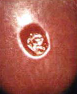 CDC image