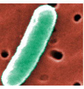 E. coli- Center for Disease Control image