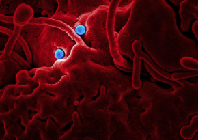 A new report says that the U.S. needs to redouble its efforts to protect Americans from the threats of infectious disease threats like MERS-CoV, pictured above on camel epthelial cells. CREDIT NIAID IN COLLABORATION WITH COLORADO STATE UNIVERSITY