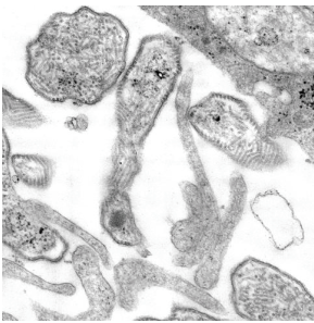 Mumps virus- CDC image