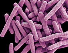 tuberculosis- CDC image